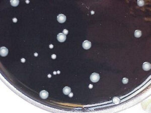 Legionella pneumophila on BCYE/DGVP 